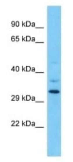 OR9Q1 Rabbit anti-Human, Polyclonal, Novus Biologicals 100 &mu;g | Buy Online | Novus Biologicals | Fisher Scientific